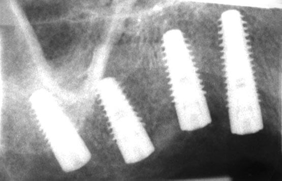 Scandrea röntgen felvétel 1