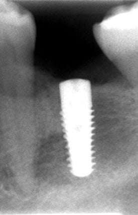 Scandrea röntgen felvétel 2