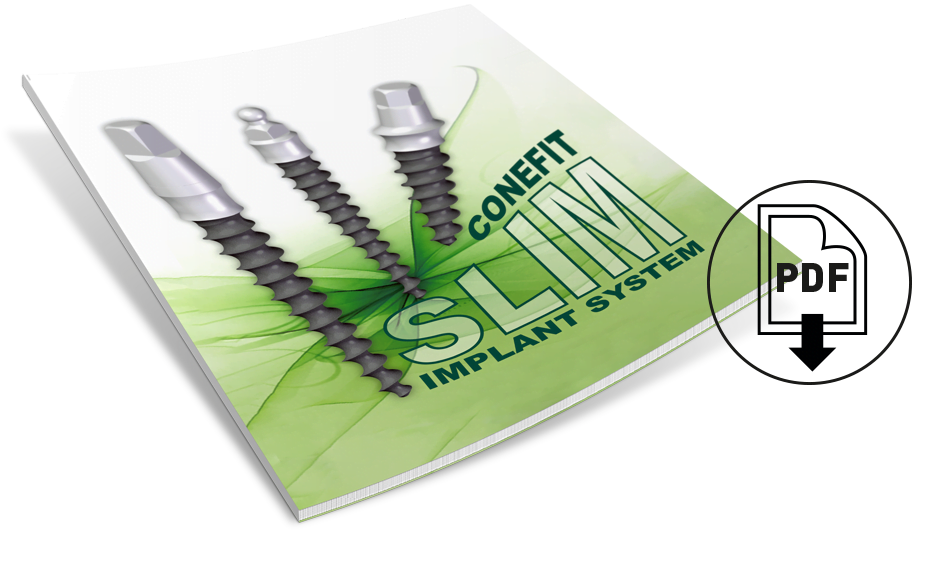 Innen letölthető a Conefit Slim implantációs rendszer katalógusa, pdf formátumban.